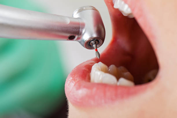 Best Dentist for Tooth Abscess  in Sharon, WI